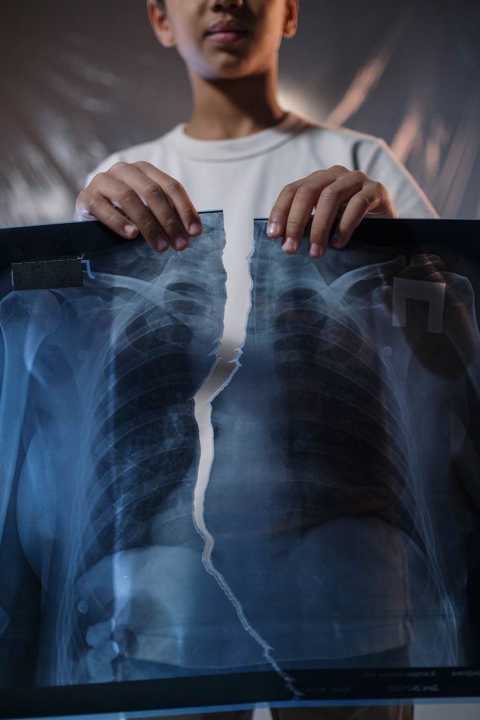 A child holds a torn X-ray image, highlighting healthcare themes. Un enfant tient une image de radiographie déchirée, mettant en évidence les thèmes des soins de santé.