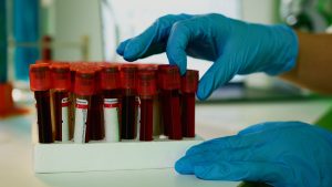 Analyse de sang au laboratoire