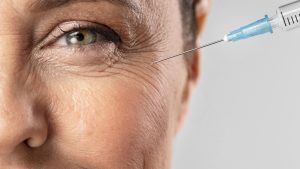 Comparaison des injections anti-âge à Toulouse : quelles solutions pour quels besoins ?